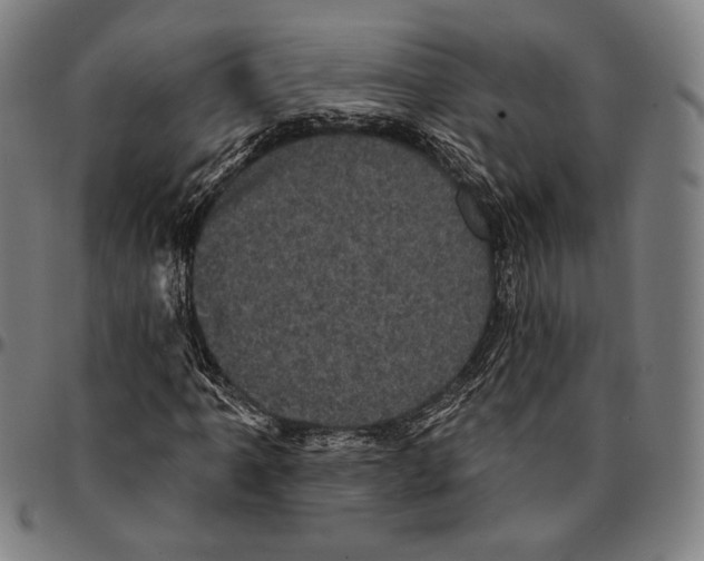 X0000095111061200801041155