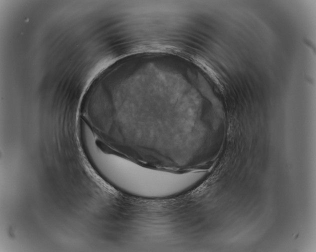 X0000095111080200801041155