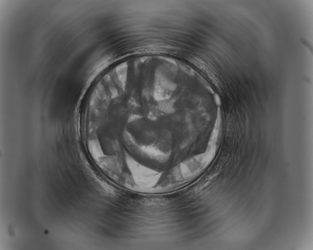 X0000095111083200801041155