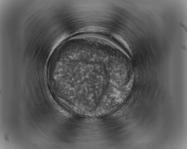 X0000095111091200801041155