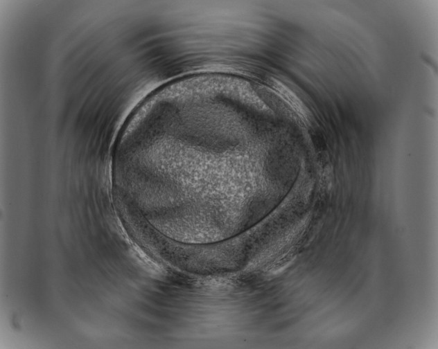 X0000095111092200801041155