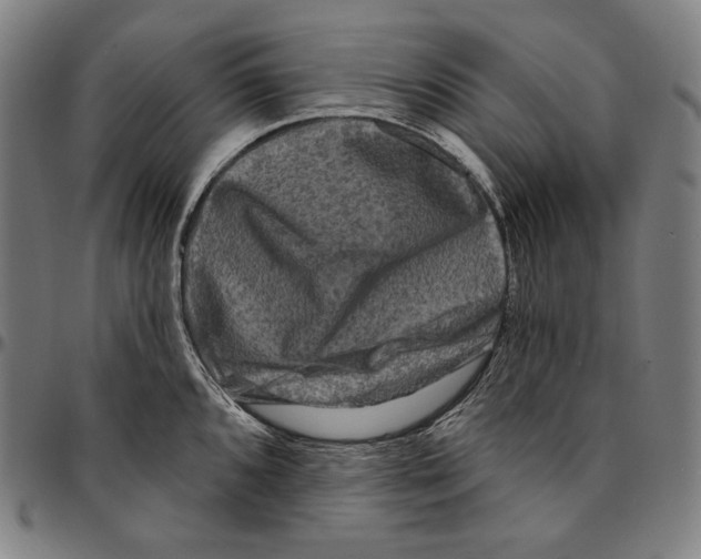 X0000095111096200801041155