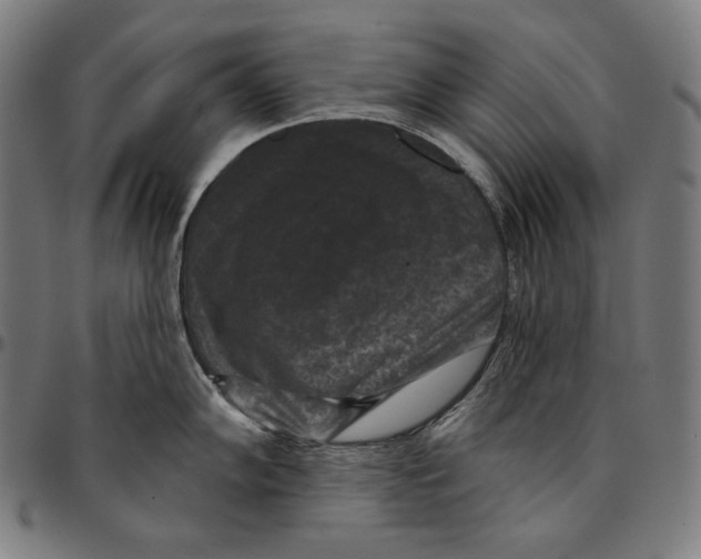 X0000095111102200801041155
