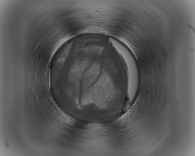 X0000095111123200801041154