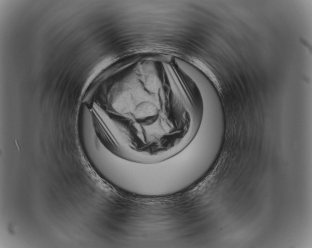 X0000095111138200801041154