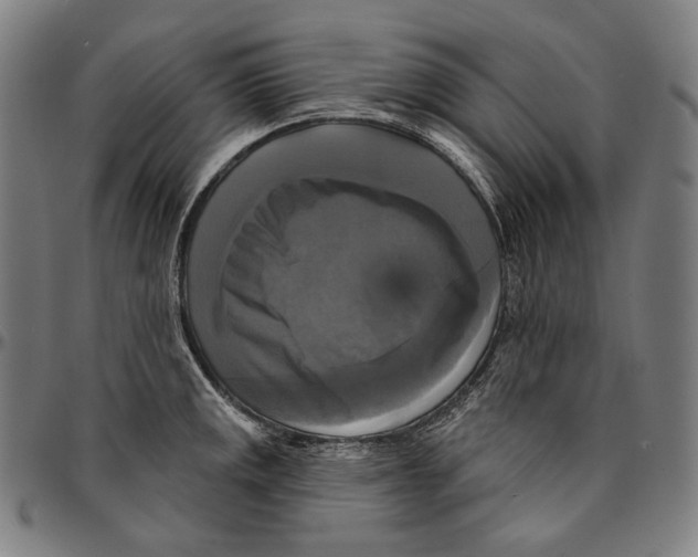 X0000095111141200801041154