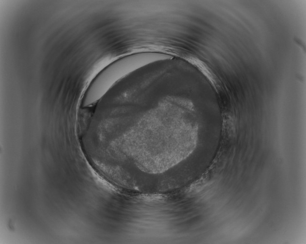 X0000095111143200801041154