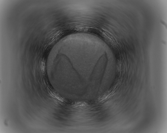 X0000095111154200801041154
