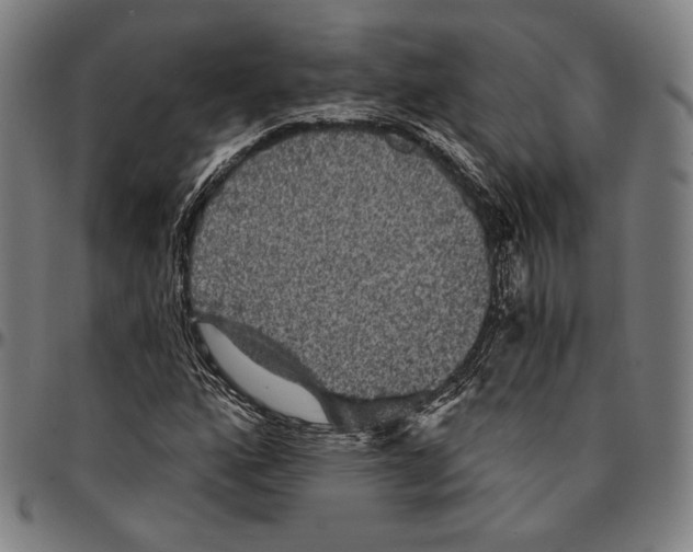 X0000095111160200801041154