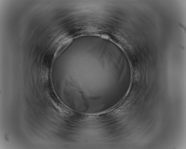 X0000095111161200801041154