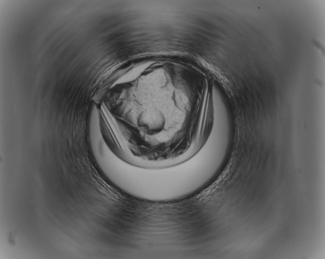X0000095111169200801041153