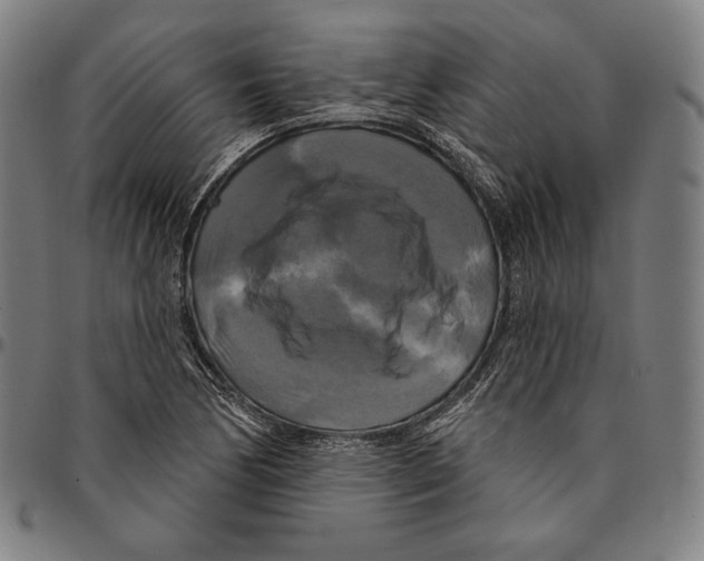 X0000095111170200801041153