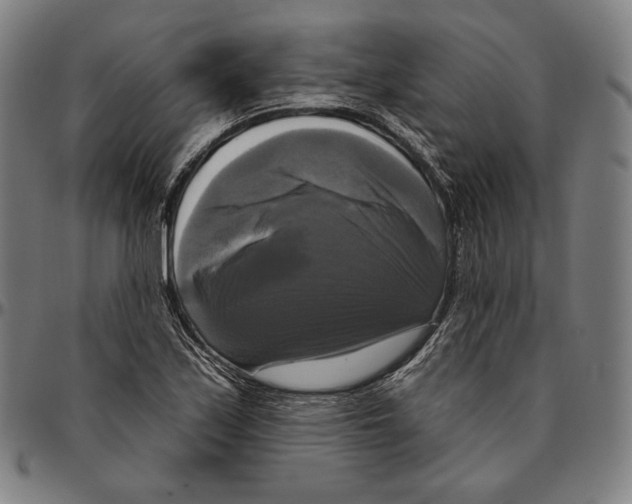 X0000095111171200801041153