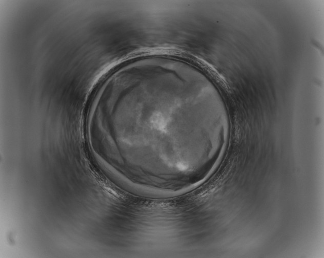 X0000095111174200801041153