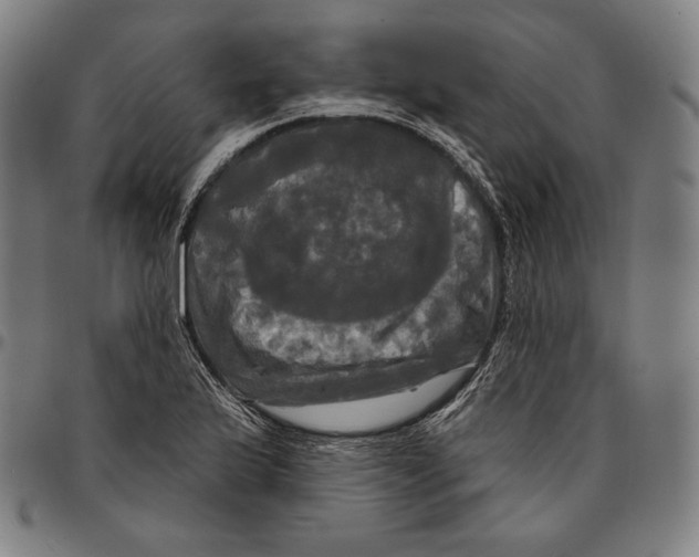 X0000095111175200801041153