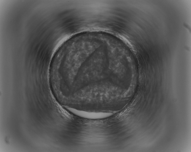 X0000095111183200801041153