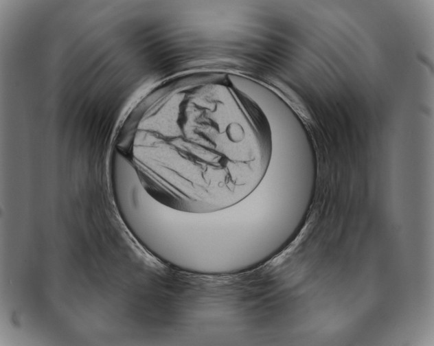 X0000095111196200801041153