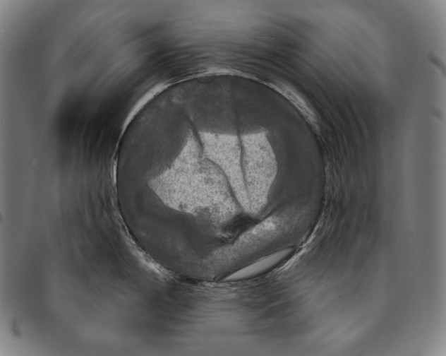 X0000095111198200801041153