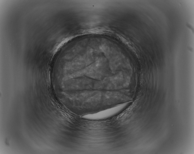 X0000095111214200801041152