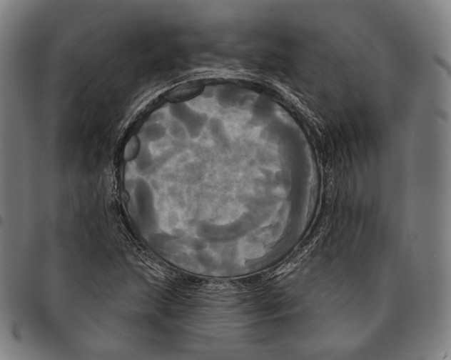 X0000095111215200801041152