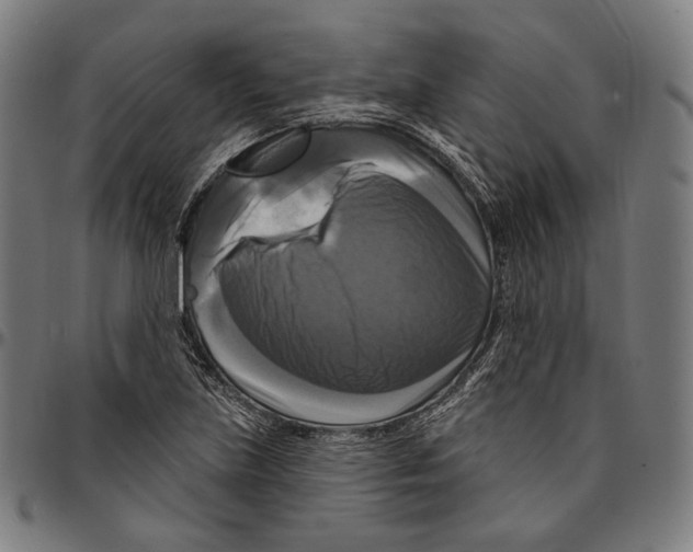X0000095111219200801041153