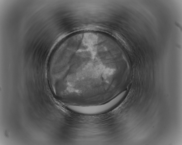 X0000095111232200801041153