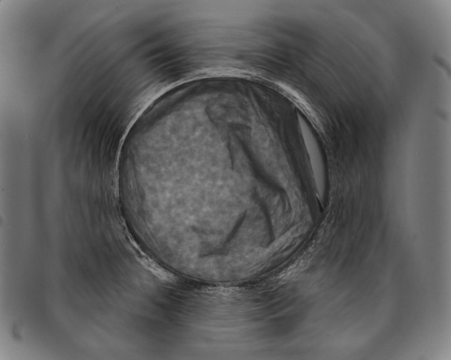 X0000095111236200801041153