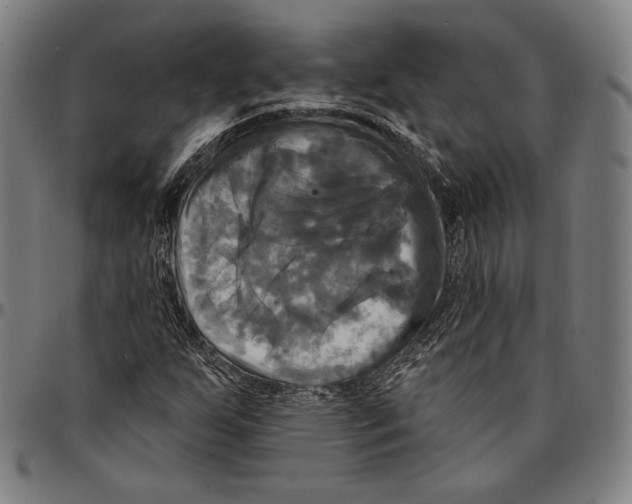 X0000095111255200801041152