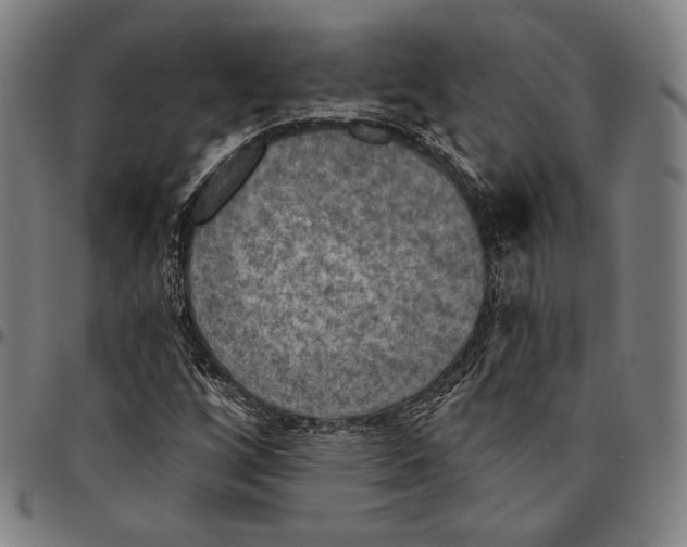 X0000095111256200801041152