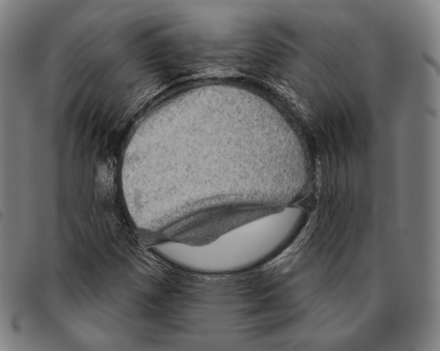 X0000095111257200801041152