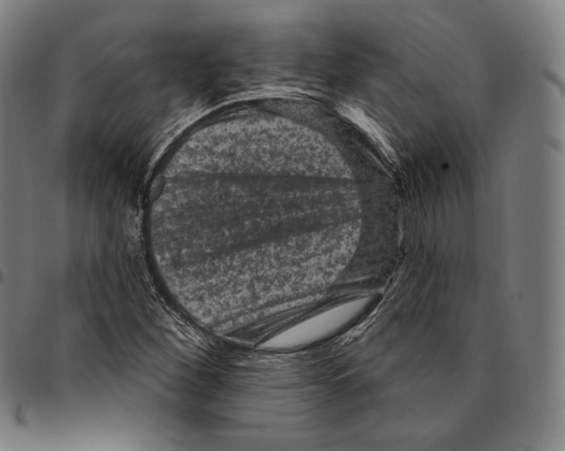 X0000095111260200801041152