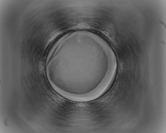 X0000095111266200801041152