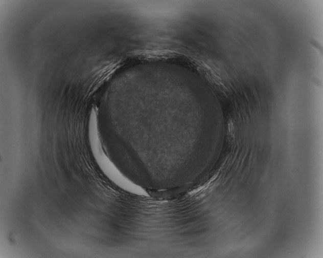 X0000095111300200801041151