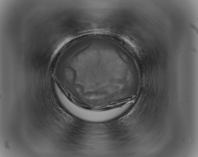 X0000095111310200801041151