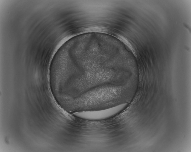 X0000095111339200801041151