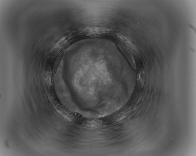 X0000095111348200801041151