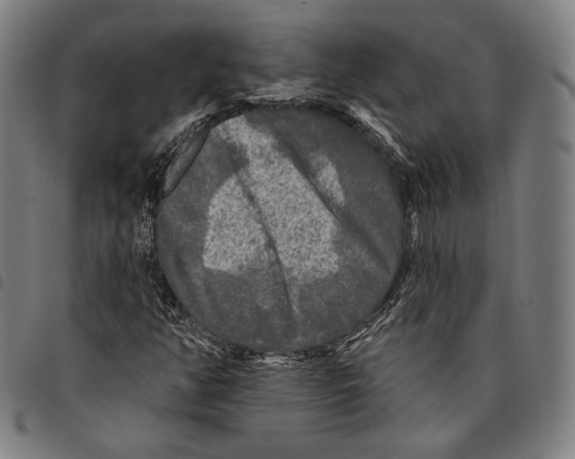 X0000095111350200801041151