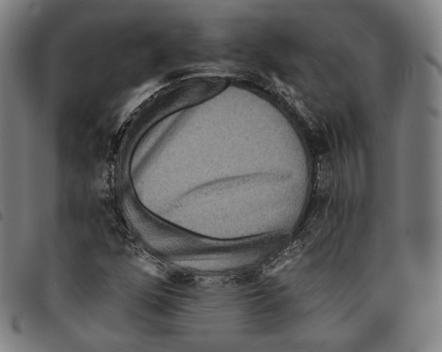 X0000095111352200801041151