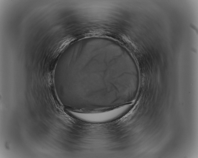 X0000095111353200801041151