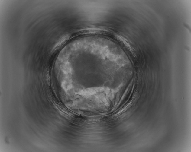 X0000095111403200801041150