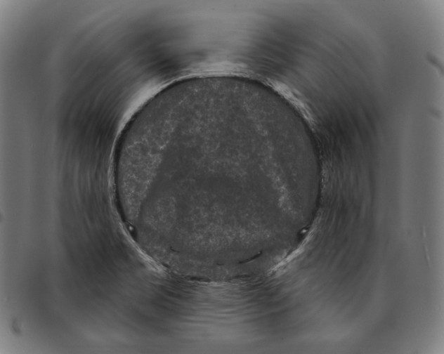 X0000095111469200801041149