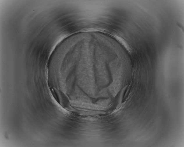 X0000095111476200801041149