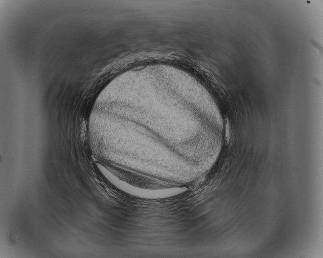 X0000095111492200801041148