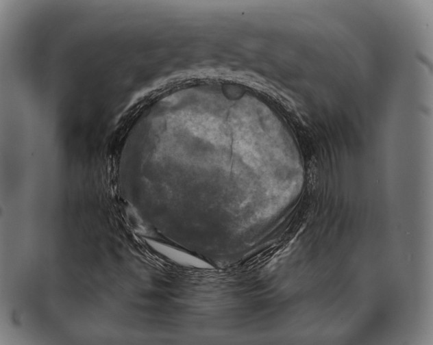 X0000095111494200801041148