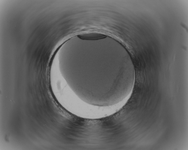 X0000095111522200801041148