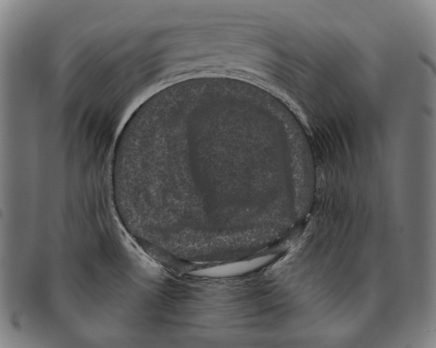 X0000095111530200801041148