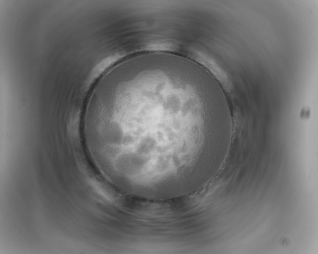 X0000095120155200712071248