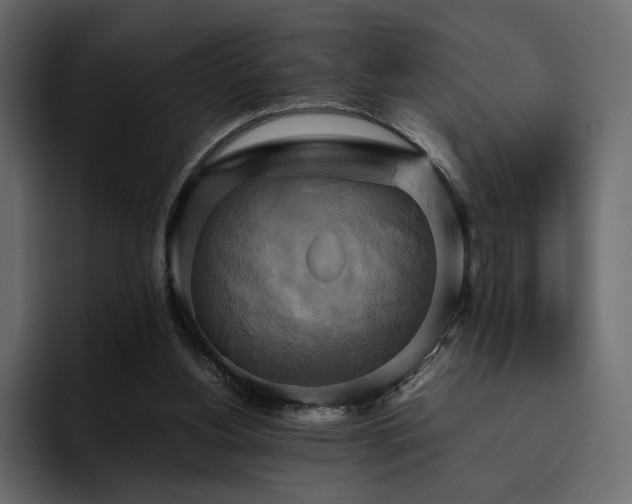 X0000095120156200712141143