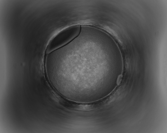 X0000095121176200712141130