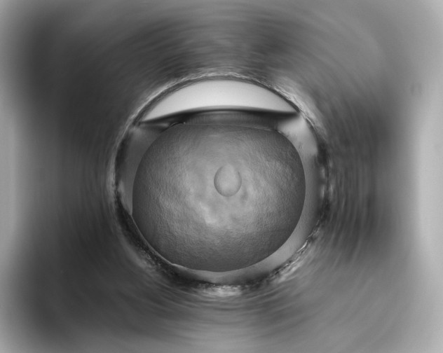 X0000095120156200712211317